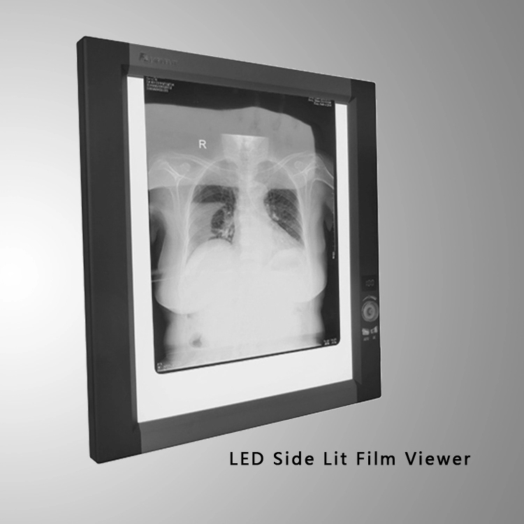 Caja de vista de película de rayos X LED