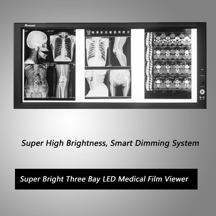 Caja de vista de pel&iacute;cula de rayos X LED