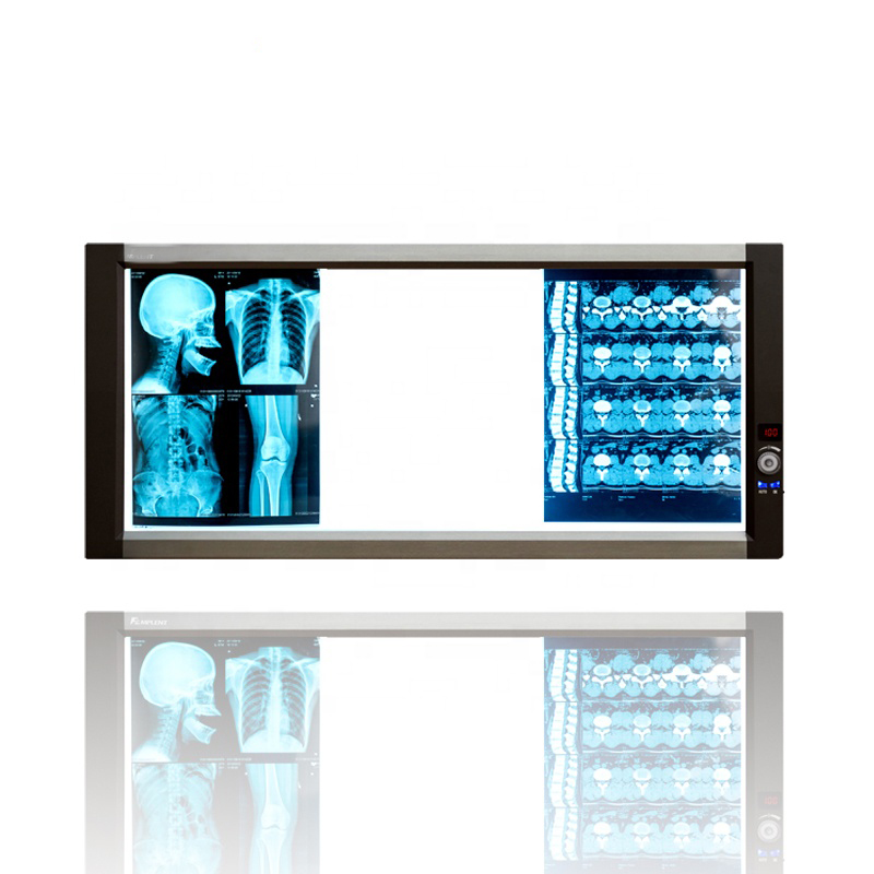 Caja de visualización de película de rayos X LED (3A)