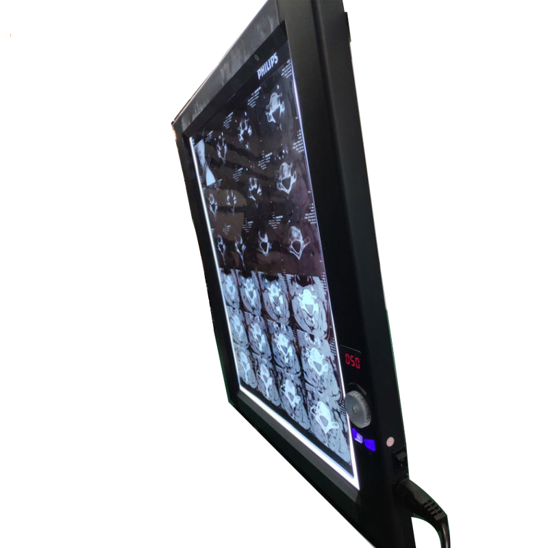 Cuadro de visualización de película de rayos X LED (1B)